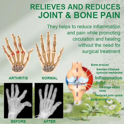 "Bee Venom Pain Relief Cream with Manuka Honey – Ultra Strength Arthritis & Joint Pain Relief"